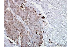 Immunohistochemistry analysis using Mouse Anti-Hsp90 alpha Monoclonal Antibody, Clone K41009 . (HSP90AA2 antibody  (AA 604-731) (Biotin))