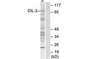 Western blot analysis of extracts from Jurkat cells, using DIL-2 Antibody. (TPX2 antibody  (AA 301-350))