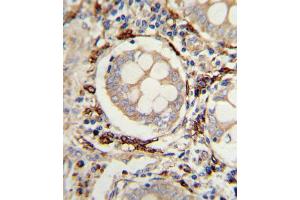 Immunohistochemistry (IHC) image for anti-Amine Oxidase, Copper Containing 3 (Vascular Adhesion Protein 1) (AOC3) antibody (ABIN3003794) (AOC3 antibody)