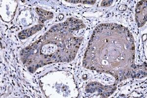 IHC analysis of p57 Kip2/CDKN1C using anti-p57 Kip2/CDKN1C antibody (ABIN7603232). (CDKN1C antibody  (N-Term))