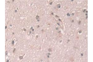 Grancalcin antibody  (AA 1-139)