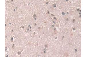 Detection of GCA in Human Cerebrum Tissue using Polyclonal Antibody to Grancalcin (GCA) (Grancalcin antibody  (AA 1-139))