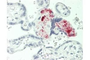 Human Placenta: Formalin-Fixed, Paraffin-Embedded (FFPE) (MGP antibody)