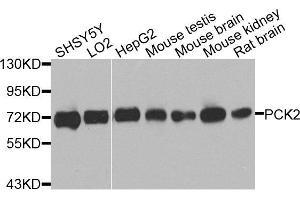 Western blot analysis of extracts of various cells, using PCK2 antibody. (PEPCK antibody)