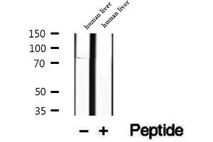 Western blot analysis of extracts of human liver tissue, using P3H3 antibody. (LEPREL2 antibody  (Internal Region))
