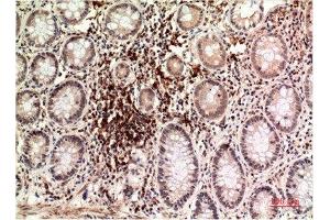 Immunohistochemical analysis of paraffin-embedded Human Colon Carcinoma Tissue using Epsilon Tubulin Mouse mAb diluted at 1:200. (TUBE1 antibody)