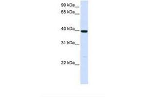 Image no. 1 for anti-Alcohol Dehydrogenase 1A (Class I), alpha Polypeptide (ADH1A) (AA 110-159) antibody (ABIN6738000) (ADH1A antibody  (AA 110-159))