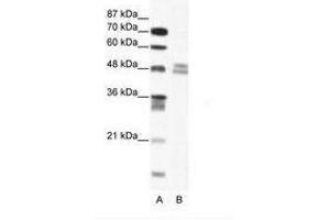 Image no. 1 for anti-Thyroid Hormone Receptor Interactor 13 (TRIP13) (AA 83-132) antibody (ABIN202513)