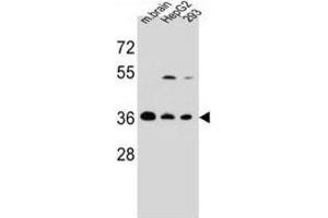 Western Blotting (WB) image for anti-F-Box Protein 2 (FBXO2) antibody (ABIN2995568)