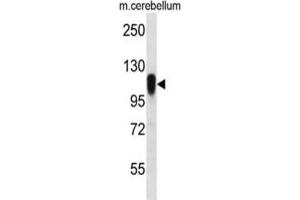 Western Blotting (WB) image for anti-F-Box Protein 41 (FBXO41) antibody (ABIN2996836)