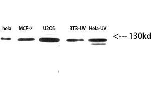 Western Blot (WB) analysis of HeLe,MCF7,U2OS,3T3-UV,HeLa-UV using Integrin β3 Polyclonal Antibody diluted at 1:2000 (Integrin beta 3 antibody  (Internal Region))