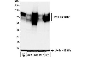Western Blotting (WB) image for anti-Nectin-1 (NECTIN1) (AA 225-275) antibody (ABIN7795684) (Recombinant Nectin-1 (NECTIN1) (AA 225-275) antibody)