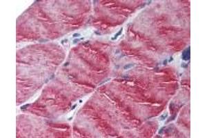Immunohistochemistry (IHC) image for anti-Myosin VB (MYO5B) (N-Term) antibody (ABIN2470476) (MYO5B antibody  (N-Term))