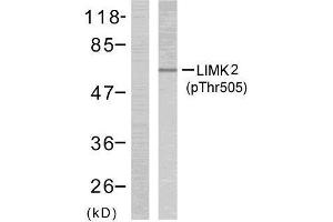 Western blot analysis of extract from NIH/3T3 cells treated or untreated with UV (60min), using LIMK2 (phospho- Thr505) antibody (E011127). (LIMK2 antibody  (pThr505))