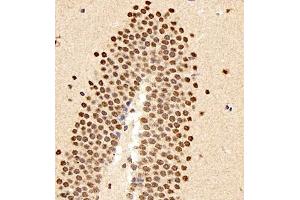 Immunohistochemistry of paraffin embedded mouse brain using smad62024 (ABIN7075629) at dilution of 1:1500 (400x lens) (SMAD6 antibody)