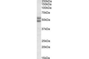 AP31064PU-N BAG5 antibody staining of nuclear HeLa lysate at 2 µg/ml (35µg protein in RIPA buffer). (BAG5 antibody  (N-Term))