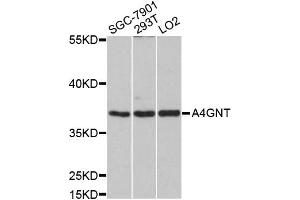 Western blot analysis of extracts of various cell lines, using A4GNT antibody (ABIN5997161) at 1/1000 dilution.