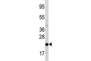 Western blot analysis of Bad antibody and HL-60 lysate. (BAD antibody  (AA 53-81))