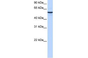 WB Suggested Anti-DPH2 Antibody Titration: 0. (DPH2 antibody  (N-Term))