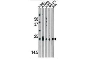 Western blot analysis of anti-Park7 (DJ-1) Antibody (N-term) in mouse brain,kidney,liver tissue lysates and NIH-3T3, Hela cell line lysates (35ug/lane).