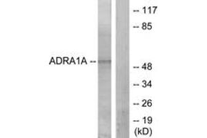 Western Blotting (WB) image for anti-Adrenoceptor alpha 1A (ADRA1A) (AA 341-390) antibody (ABIN2889851) (alpha 1 Adrenergic Receptor antibody  (AA 341-390))
