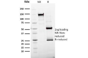 SDS-PAGE Analysis Purified Ki67 Mouse Monoclonal Antibody (MKI67/2465). (Ki-67 antibody  (AA 2293-2478))
