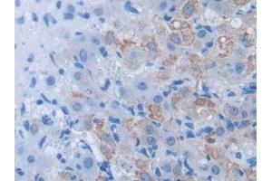 IHC-P analysis of Mouse Ovary Tissue, with DAB staining. (BDNF antibody  (AA 139-249))