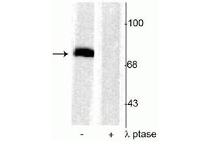 Western Blotting (WB) image for anti-Synapsin I (SYN1) (pSer603) antibody (ABIN361493)