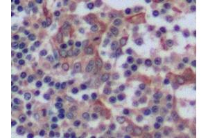 Detection of CK8 in Human Tonsil Tissue using Polyclonal Antibody to Cytokeratin 8 (CK8) (KRT8 antibody  (AA 92-393))