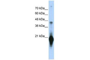 C17ORF49 antibody used at 1 ug/ml to detect target protein. (C17orf49 antibody  (Middle Region))