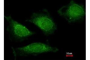 Immunofluorescence analysis of methanol-fixed HeLa, using DNA polymerase gamma antibody at 1:200 dilution. (POLG antibody  (AA 829-1201))
