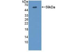 Detection of Recombinant EVPL, Human using Polyclonal Antibody to Envoplakin (EVPL) (Envoplakin antibody  (AA 3-258))