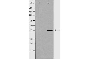 Western blot analysis of hnRPD expression in 293 cell extract.