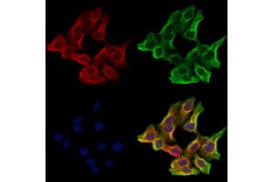 ABIN6265743 and ABIN6273181 staining Hela cells by IF/ICC. (TRIM9 antibody  (N-Term))