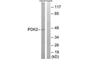Western blot analysis of extracts from HepG2 cells, using PDK2 Antibody. (PDK2 antibody  (AA 260-309))
