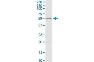 ADA MaxPab rabbit polyclonal antibody. (ADA antibody  (AA 1-363))