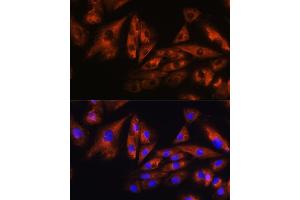 Immunofluorescence analysis of H9C2 cells using  Rabbit pAb (ABIN1678800, ABIN3019073, ABIN3019074 and ABIN6220701) at dilution of 1:100. (Ataxin 10 antibody  (AA 346-475))