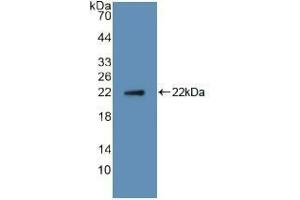 Western blot analysis of recombinant Human RANkL. (RANKL antibody  (AA 79-247))