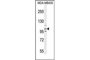 Western blot analysis of PEAR1 Antibody (C-term) in MDA-MB435 cell line lysates (35ug/lane). (PEAR1 antibody  (C-Term))