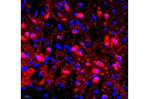 Immunofluorescence of paraffin embedded rat brain using NECAB1 (ABIN7074753) at dilution of 1: 2300 (400x lens) (NECAB1 antibody)