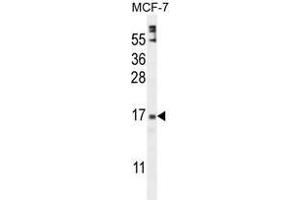 ZNF720 Antibody (Center) western blot analysis in MCF-7 cell line lysates (35 µg/lane). (ZNF720 antibody  (Middle Region))