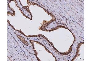 IHC analysis of CLASP1 using anti-CLASP1 antibody (ABIN7599144). (CLASP1 antibody  (AA 1-243))