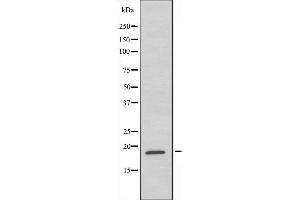 Western blot analysis of extracts from HeLa cells,using RPL35 antibody.