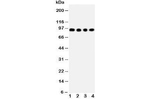 Western blot testing of ADAM17 antibody and Lane 1:  human placenta;  2: HeLa;  3: PANC;  4: 293T cell lysate. (ADAM17 antibody  (C-Term))