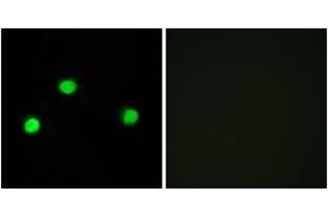 Immunofluorescence analysis of COS7 cells, using IP6K2 Antibody. (IP6K2 antibody  (AA 161-210))