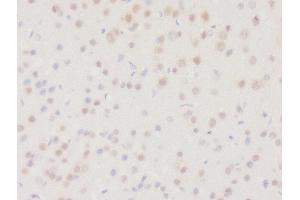 Formalin-fixed and paraffin embedded rat brain tissue labeled with Rabbit Anti-DHRS2 Polyclonal Antibody, Unconjugated (ABIN2559682) at 1:200 followed by conjugation to the secondary antibody and DAB staining (DHRS2 antibody  (AA 61-160))