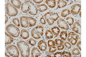 Immunoperoxidase of monoclonal antibody to AATK on formalin-fixed paraffin-embedded human stomach. (AATK antibody  (AA 161-260))