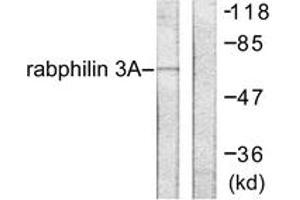 Western blot analysis of extracts from HeLa cells, treated with TNF-a 20ng/ml 2', using Rabphilin 3A (Ab-Ser237) Antibody.