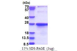SDS-PAGE (SDS) image for Exosome Component 1 (EXOSC1) (AA 1-195) protein (His tag) (ABIN5777545) (EXOSC1 Protein (AA 1-195) (His tag))