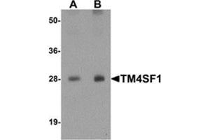 Western blot analysis of TM4SF1 in human lung tissue lysate with TM4SF1 antibody at (A) 0. (TM4SF1 antibody  (N-Term))